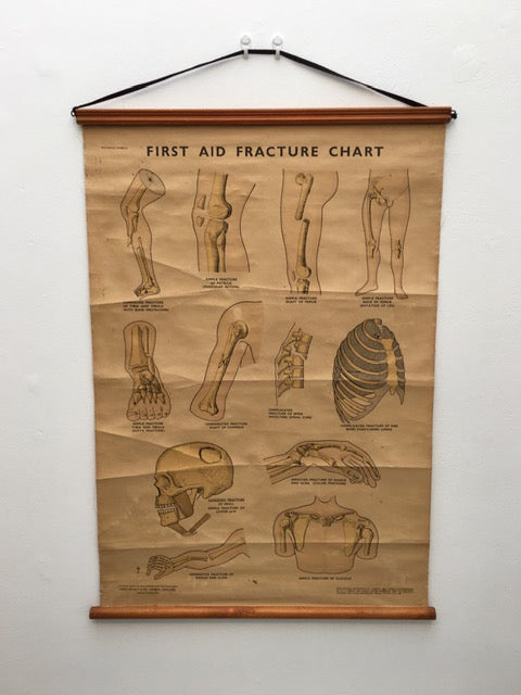 Original Cool vintage “ first and fracture chart medical poster