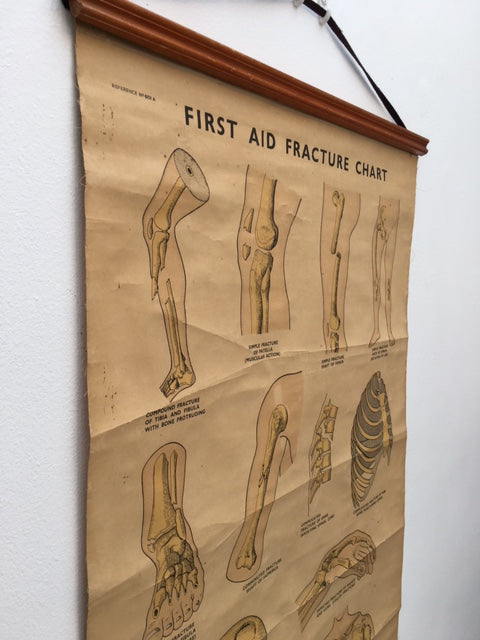Original Cool vintage “ first and fracture chart medical poster